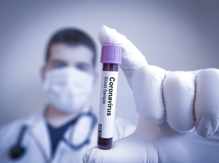 Scoperto il quarto fattore di rischio per il coronavirus